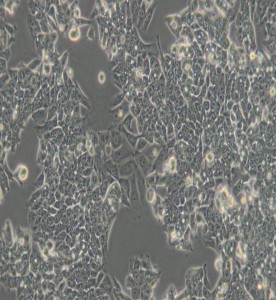 LoVo人結(jié)腸癌細(xì)胞主圖