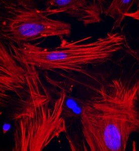 大鼠子宮平滑肌細(xì)胞主圖