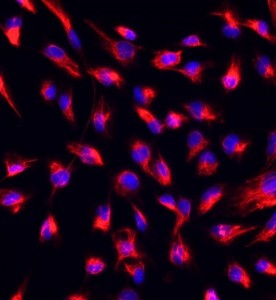 大鼠心肌成纖維細(xì)胞主圖