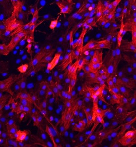 大鼠主動脈平滑肌細(xì)胞主圖