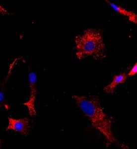 大鼠關(guān)節(jié)軟骨細(xì)胞主圖