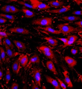 大鼠心臟微血管內(nèi)皮細(xì)胞主圖