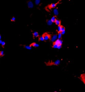 人肺大動(dòng)脈內(nèi)皮細(xì)胞主圖
