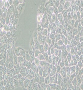 KYSE-510人食管癌細(xì)胞主圖