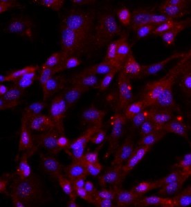 人關(guān)節(jié)軟骨細(xì)胞主圖