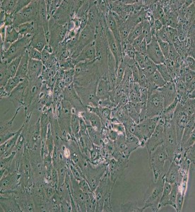 PED豬內(nèi)皮細(xì)胞主圖