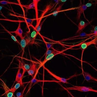 切片全景掃描（熒光雙標(biāo)三色）主圖